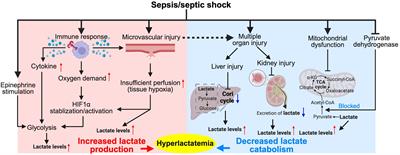 Lactate’s impact on immune cells in sepsis: unraveling the complex interplay